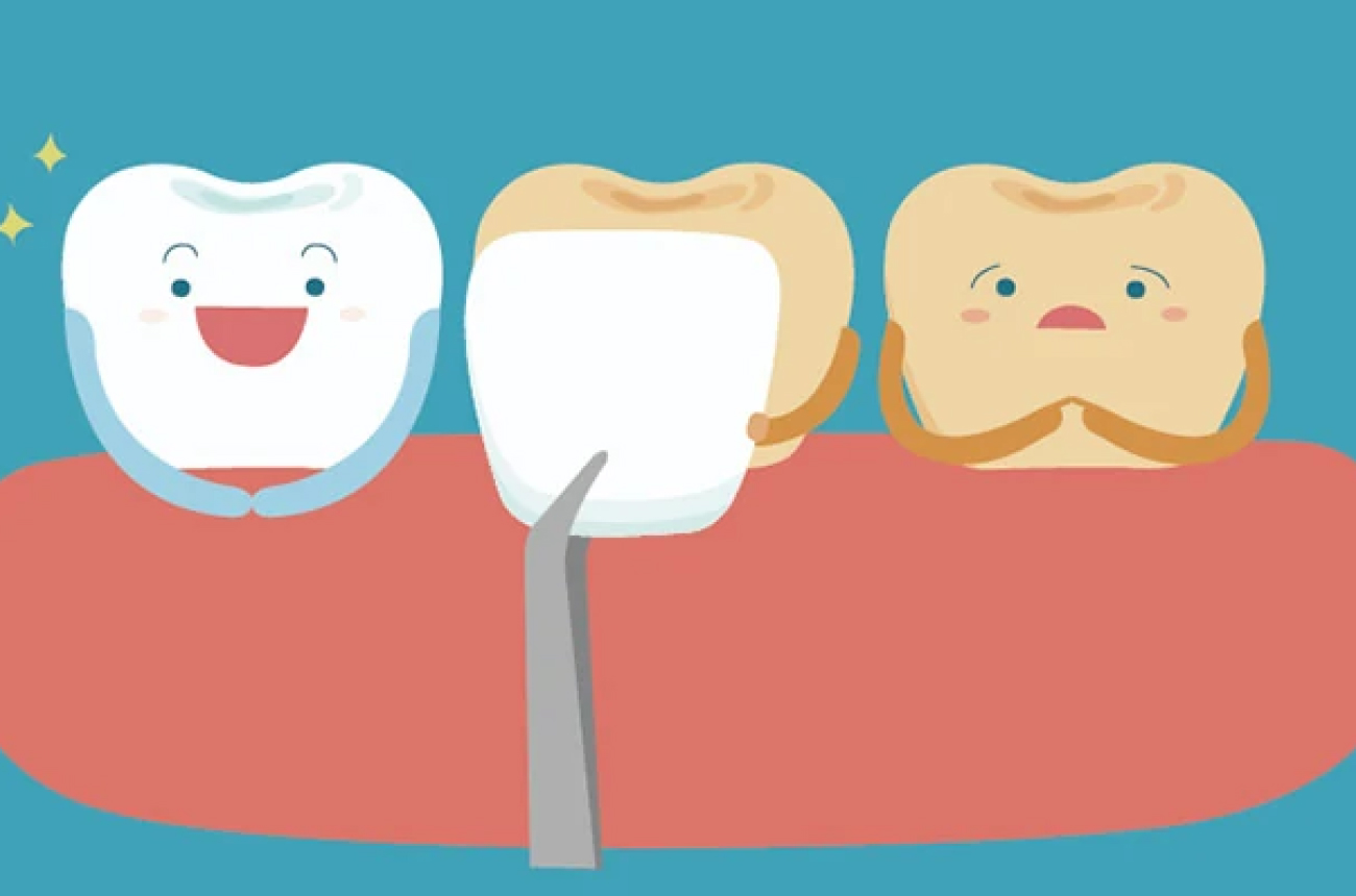 Bellevue Dental Full Site